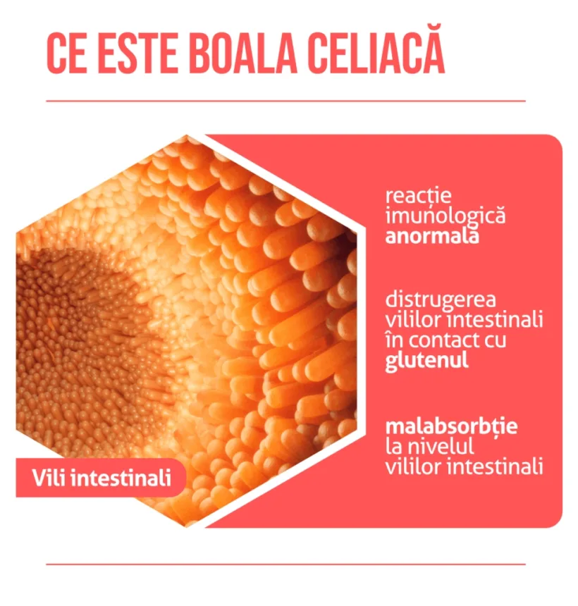 Intoleranța la gluten poate duce la cancer