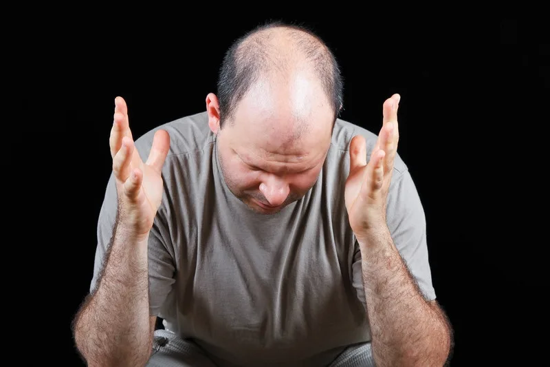 Calviţia sau alopecia, o boală moştenită?